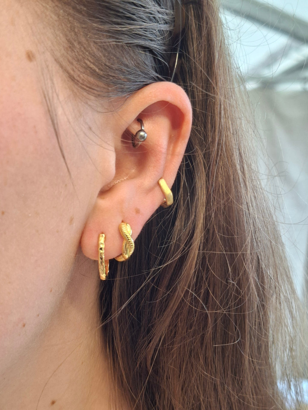 Radial Hoops